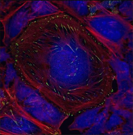 CellLight® Talin-GFP, BacMam 2.0 (Cat. No. C10611) was used to transduce HeLa cells. After overnight incubation, the Click-iT® OPP reagent was added and incubated for 30 minutes. The cells were then fixed and permeabilized, and treated with Alexa Fluor® 568 Phalloidin (Cat. No. A12380). The labeling of the nascent protein synthesis was completed using the Click-iT® Plus OPP Alexa Fluor® 647 Protein Synthesis Assay Kit (Cat. No. C10458).<br><br>
Green—indentifies the binding of the talin-GFP fusion protein to the cytoskeleton.<br>
Red—Alexa Fluor®-Phalloidin, identifies the F-actin staining within the cell<br>
Blue punctuate pattern within the nucleus—nascent protein synthesis detected by application of the Click-iT® Plus OPP Alexa Fluor® 647 Protein Synthesis Assay