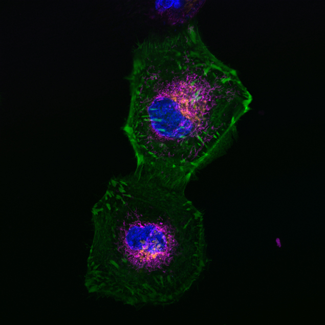 hoechst 33342 solution 5ml