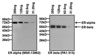 https://tools.thermofisher.com/content/sfs/gallery/thumb/Estrogen-Receptor-Antibody-MA5-13062-Western-blot-2_20150417140649.jpg