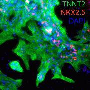 Characterization of cardiomyocytes using the Human Cardiomyocyte ICC Kit